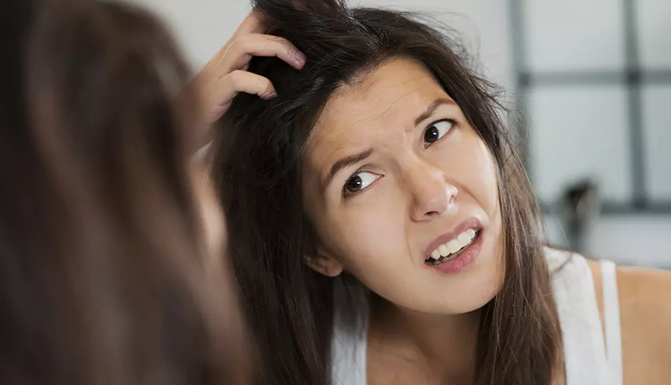 Dealing With Dandruff