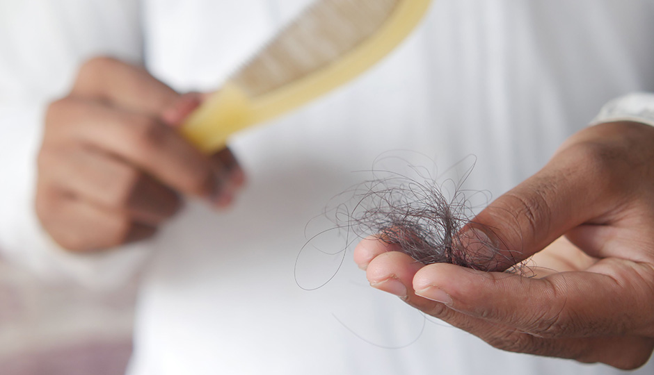 7 Signs It Might Be Time to Explore Hair Replacement Options